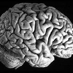 Il cervello dei ricchi ha meno stimoli degli altri