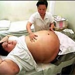 Obesit�: chi si opera allunga gli anni di vita